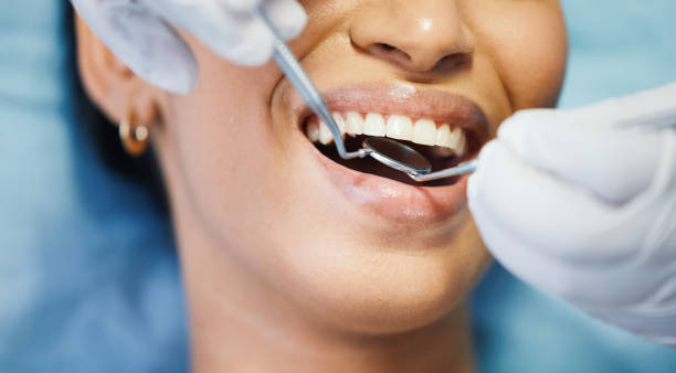 Best Emergency Treatment for Dental Infections or Abscesses in Mayfield, PA